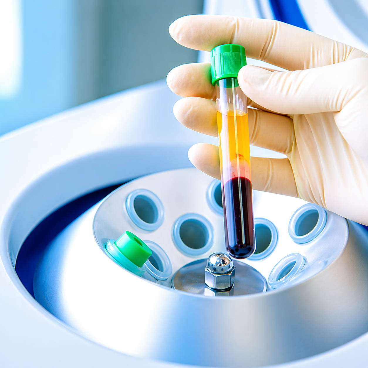 Doctor-led regenerative medicine consultation at Da Vinci Healife KL